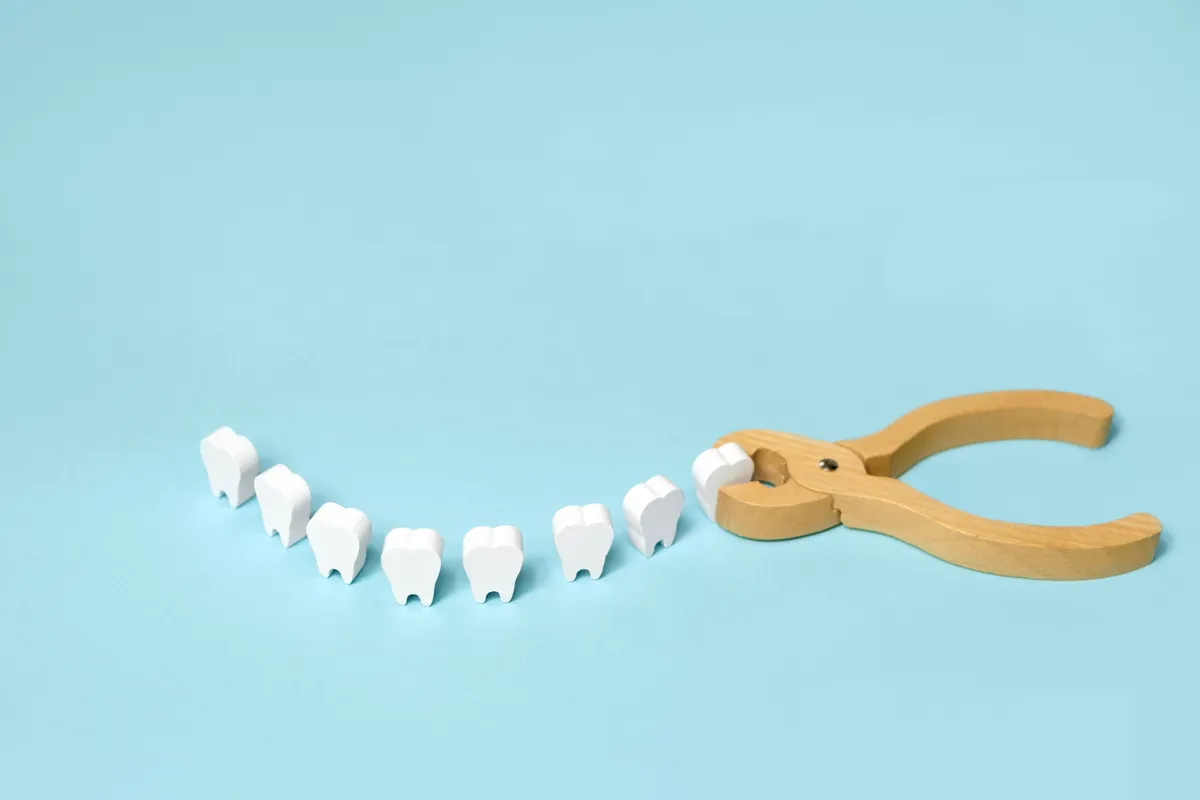 Tooth Extraction With Immediate Implant Placement: What to Expect