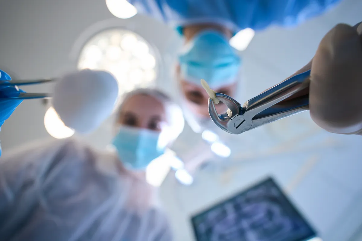 Wisdom Tooth Removal: A Guide for Adults Who Delayed Extraction