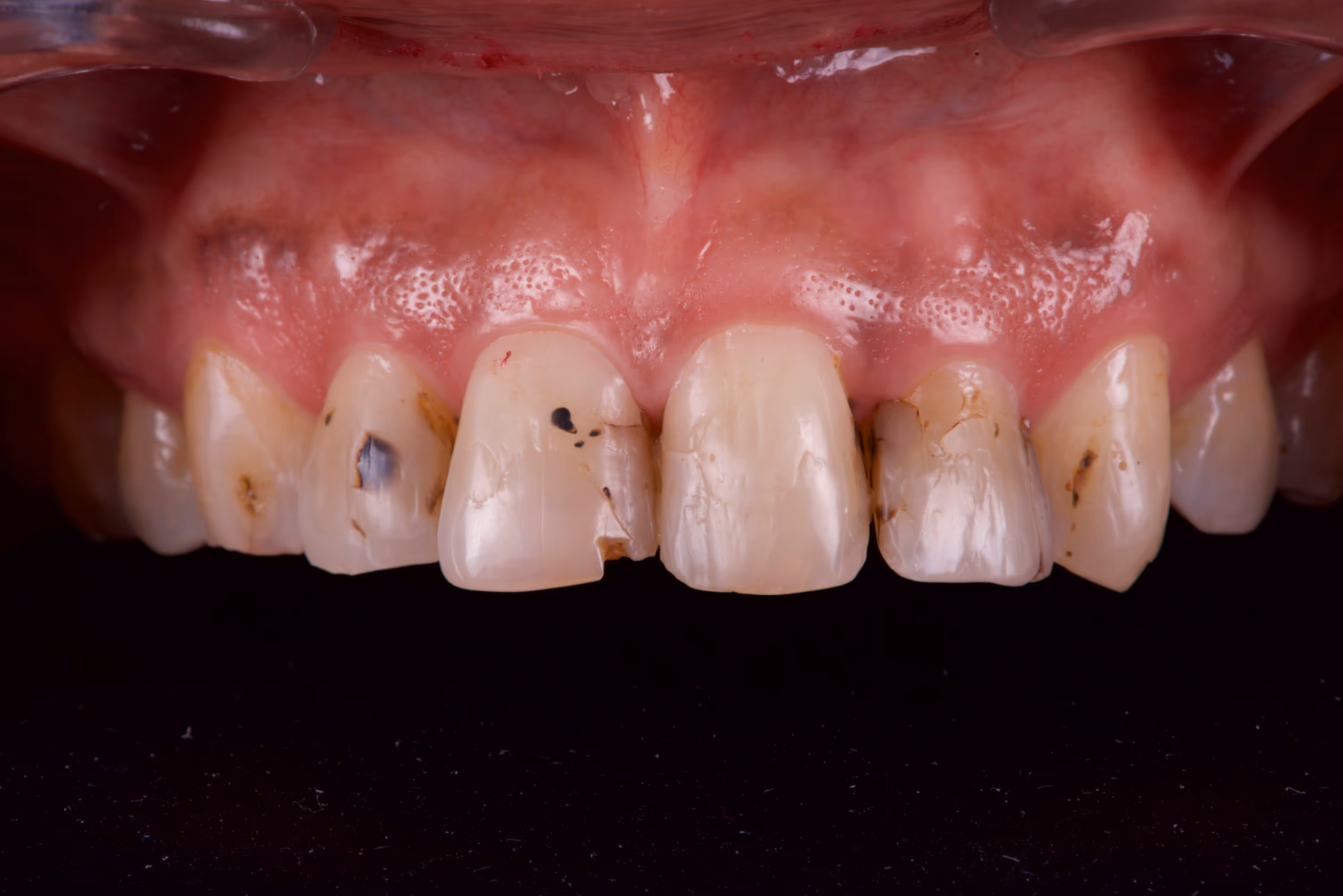 Dr. Peñalva dental clinic in Mexico City