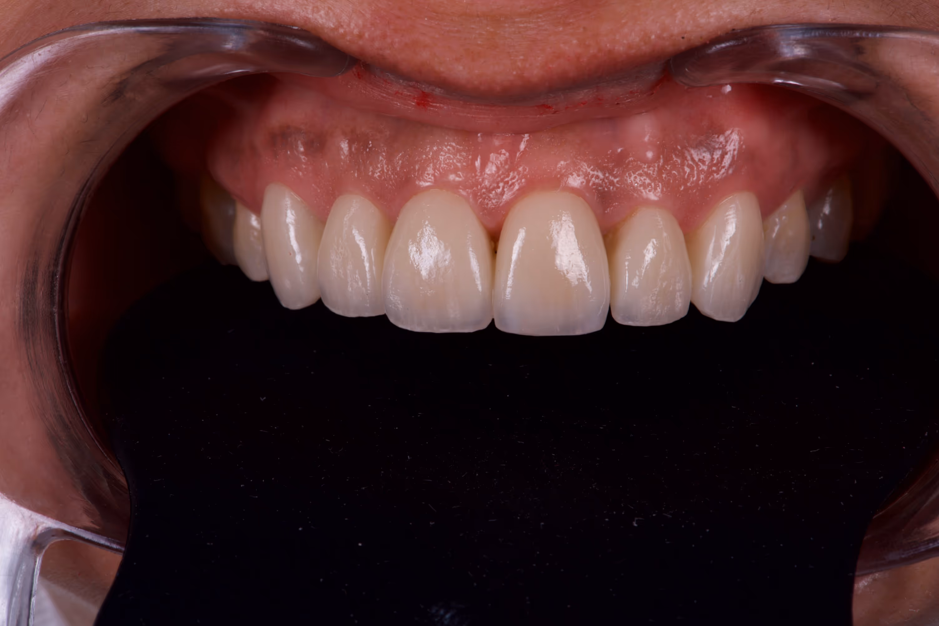 Dr. Peñalva dental clinic in Mexico City