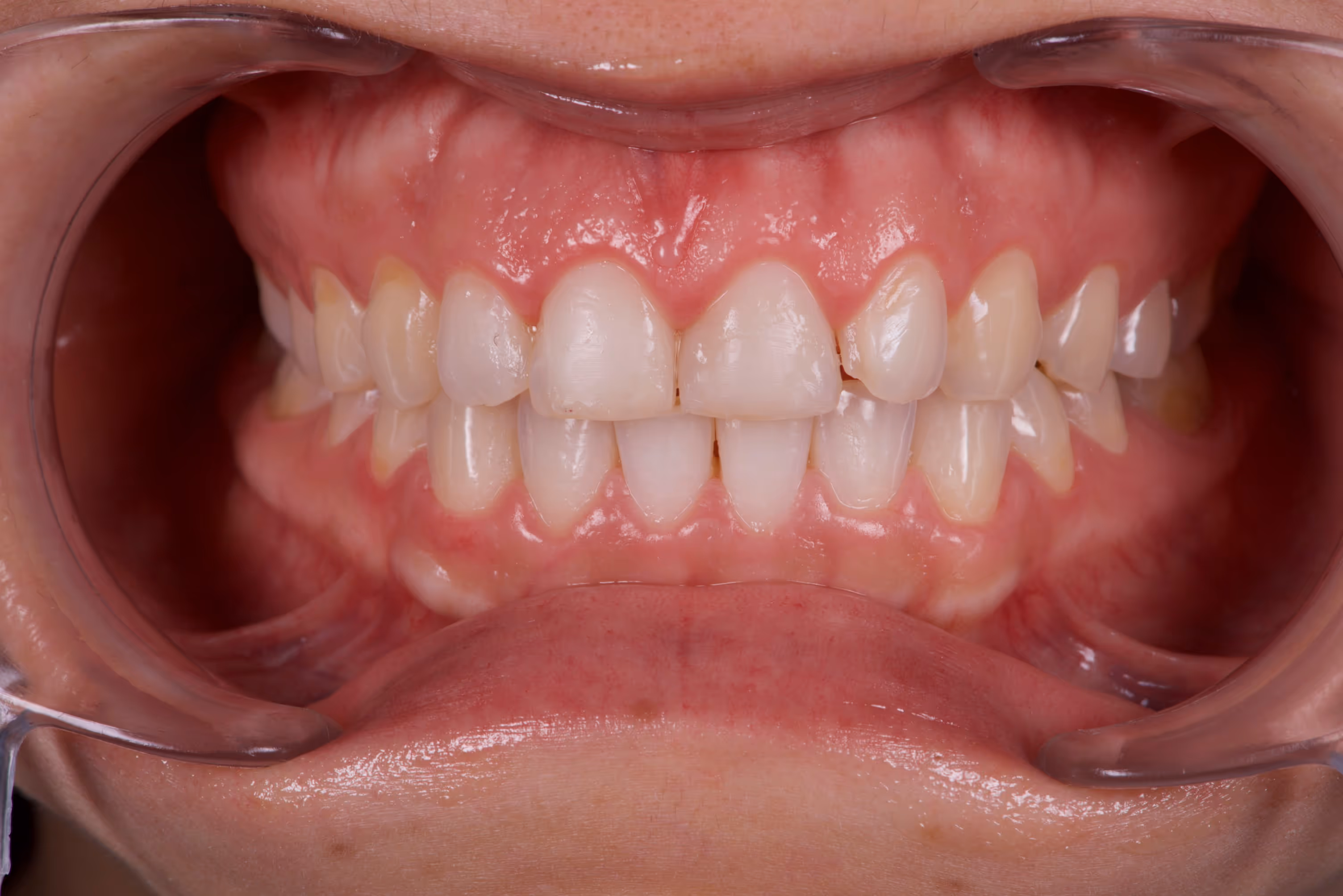 Dr. Peñalva dental clinic in Mexico City