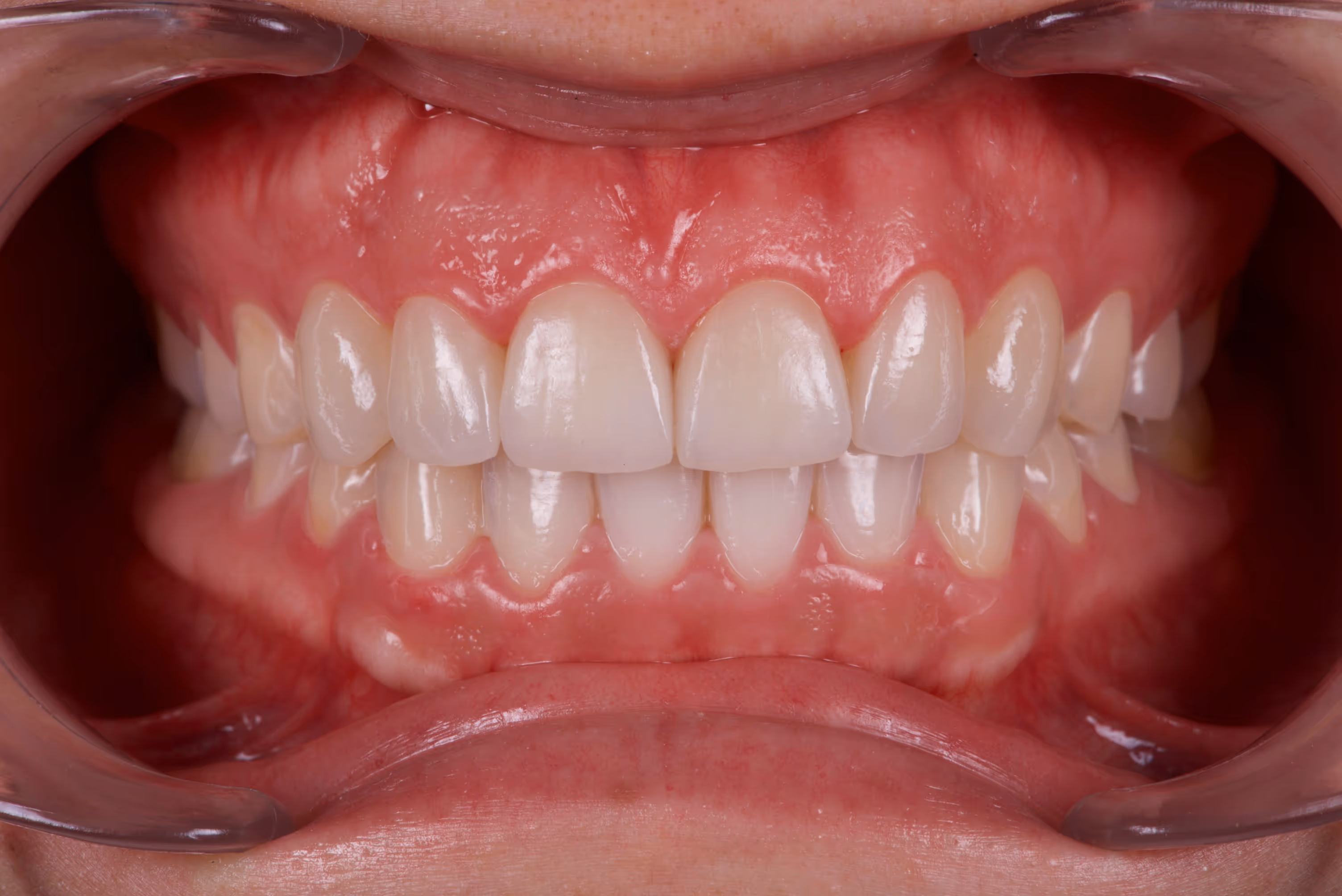 Dr. Peñalva dental clinic in Mexico City