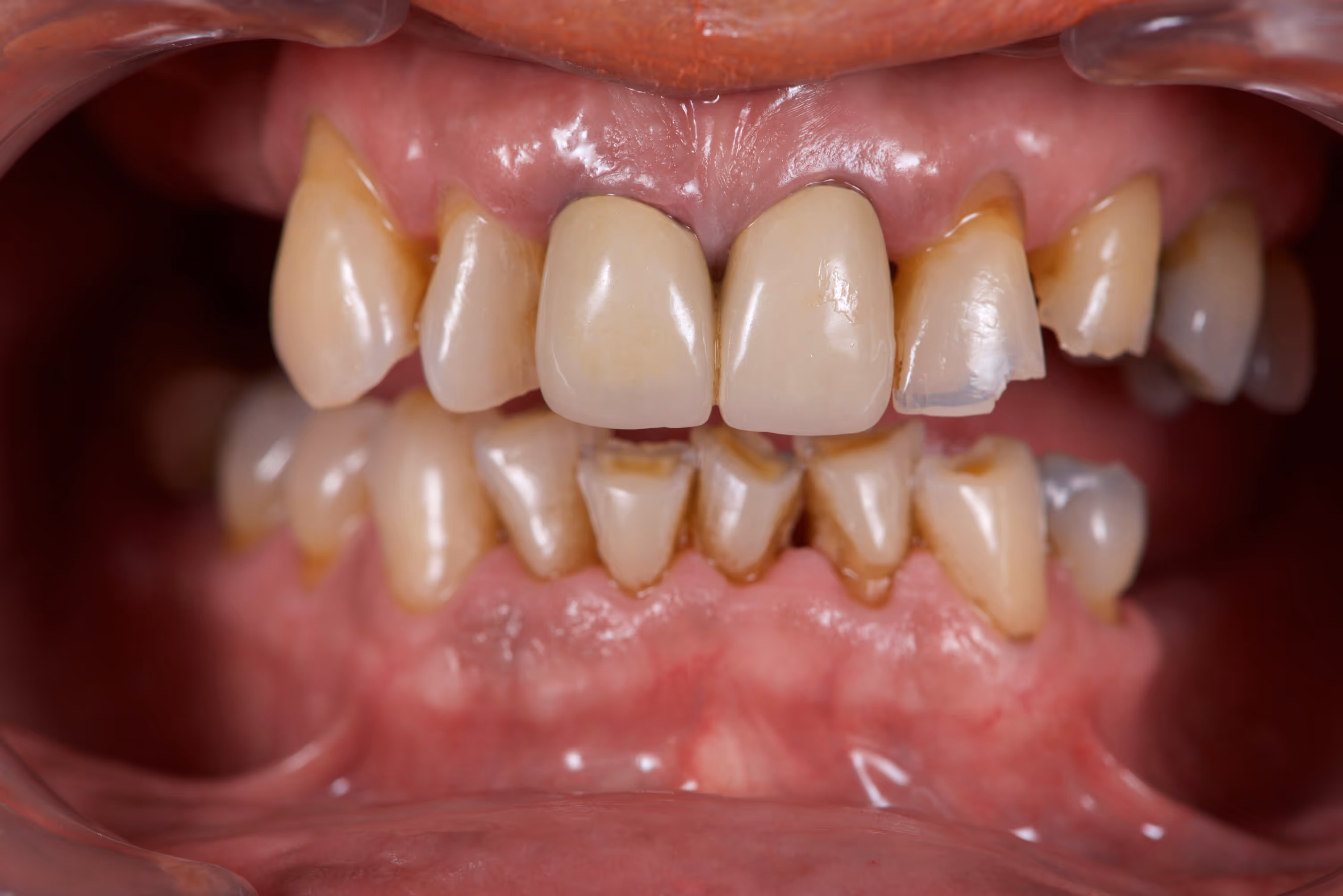 Dr. Peñalva dental clinic in Mexico City