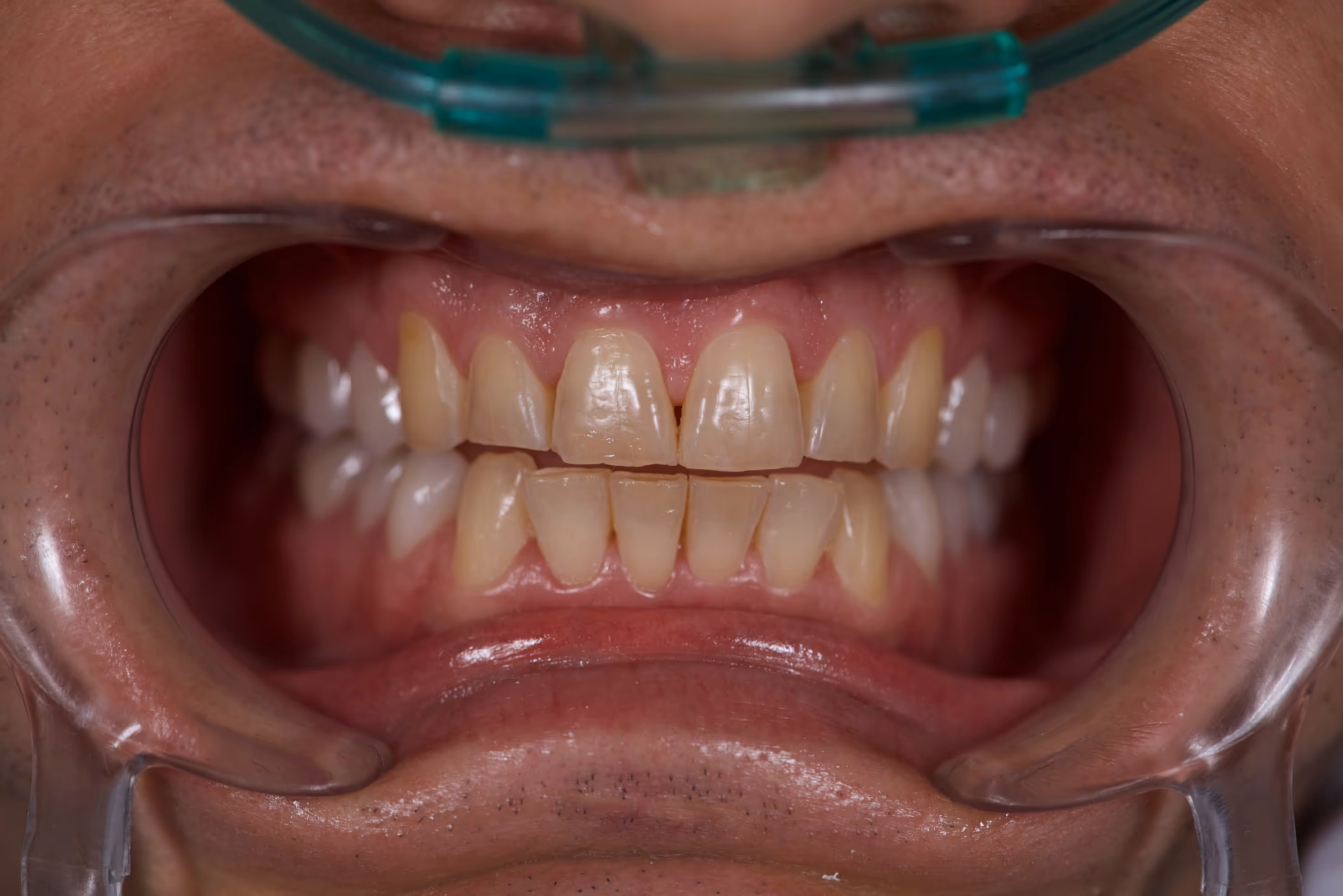 Dr. Peñalva dental clinic in Mexico City