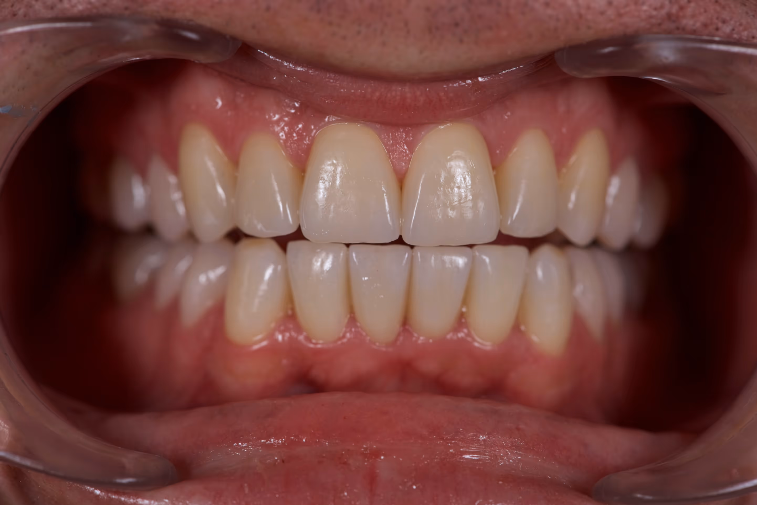 Dr. Peñalva dental clinic in Mexico City