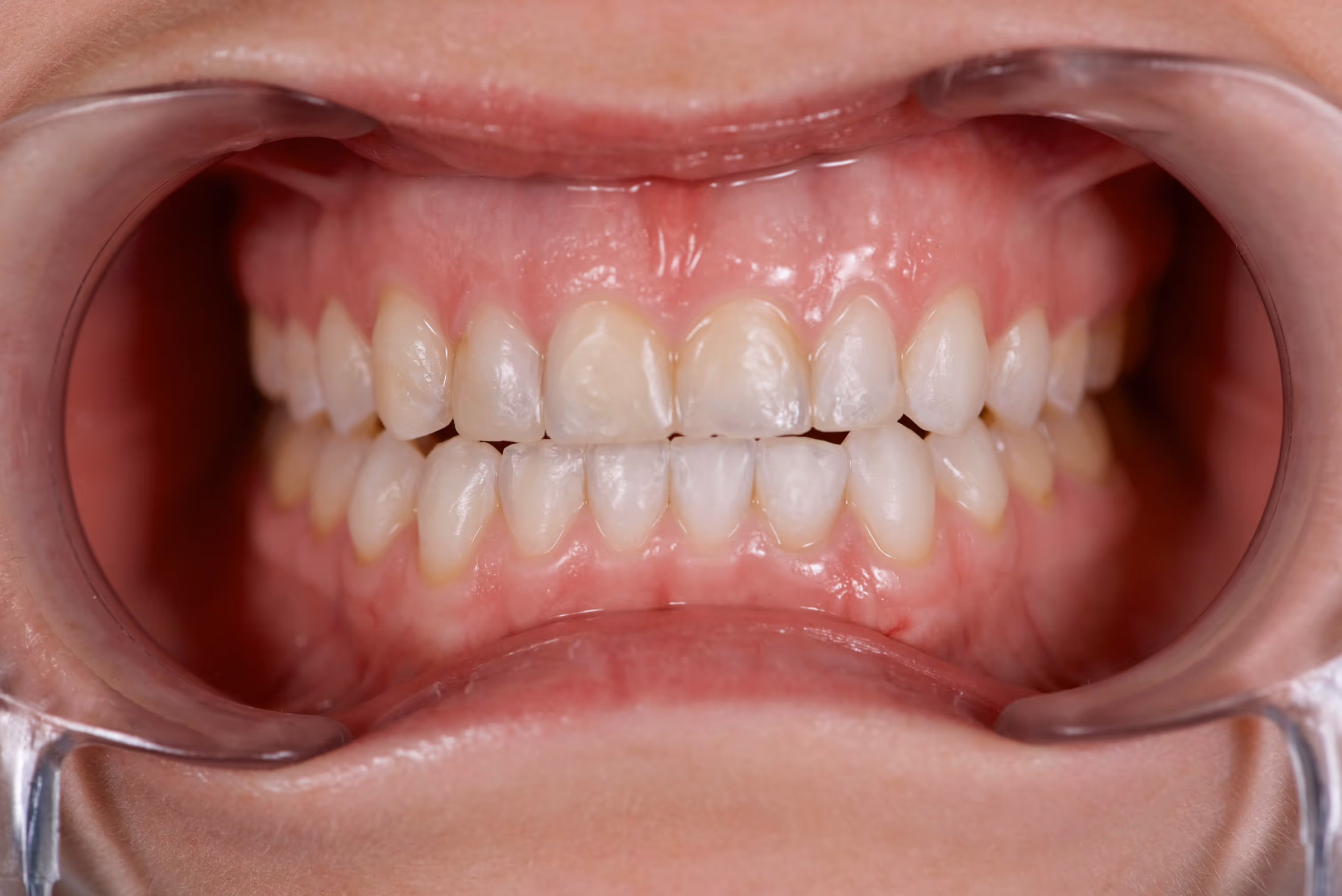 Dr. Peñalva dental clinic in Mexico City