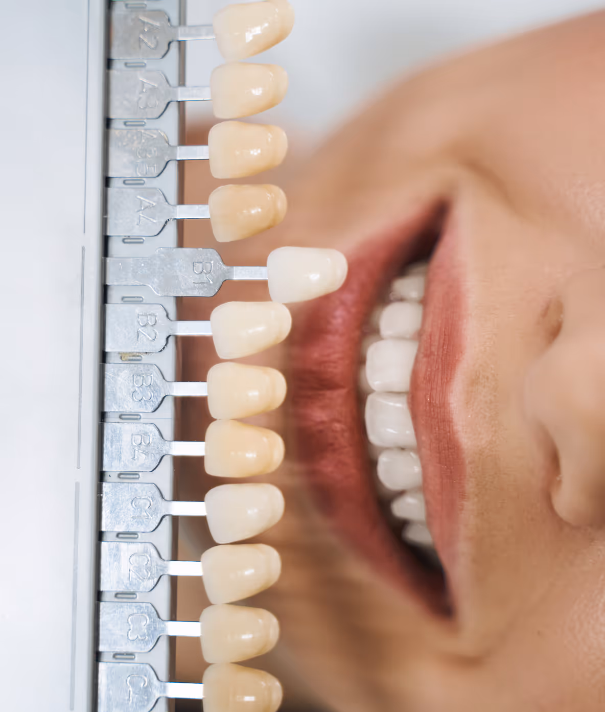 Cosmetic dentistry and smile design with Dr. Andrés Peñalva