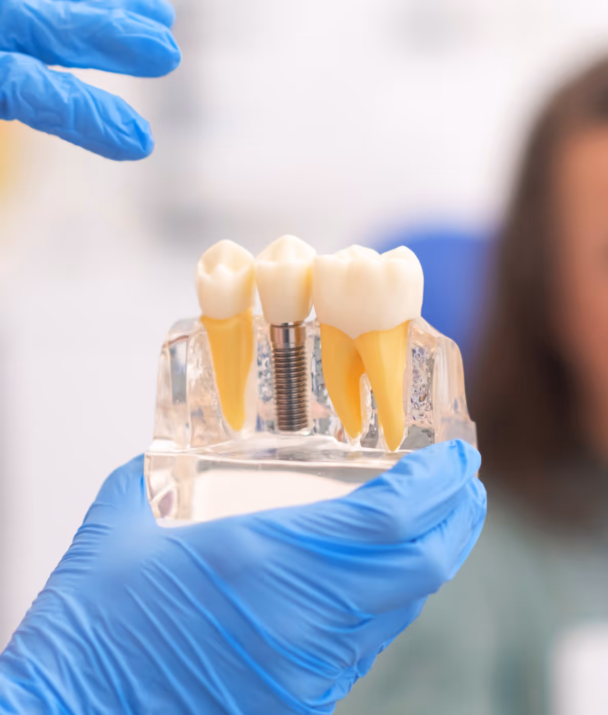 Dental implants treatment with Dr. Andrés Peñalva in Mexico City